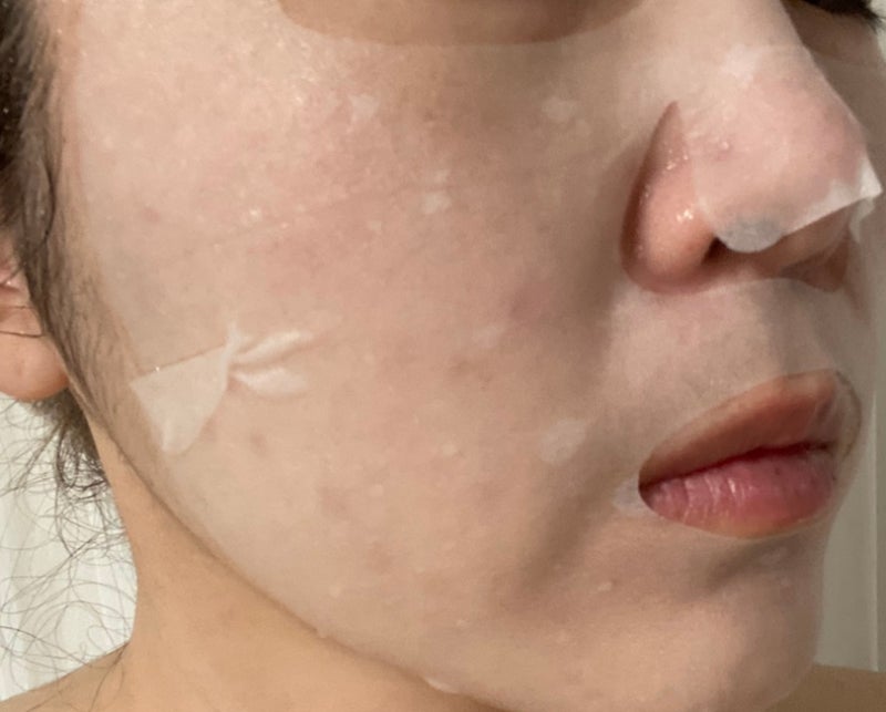 메디힐 마데카소사이드 흔적 방벽 케어 마스크팩 1일 1팩 10일 동안 하면 효과가 있을까