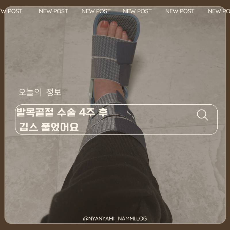 발목골절 수술 후 깁스 제거 후기 4주차부터 걷기까지