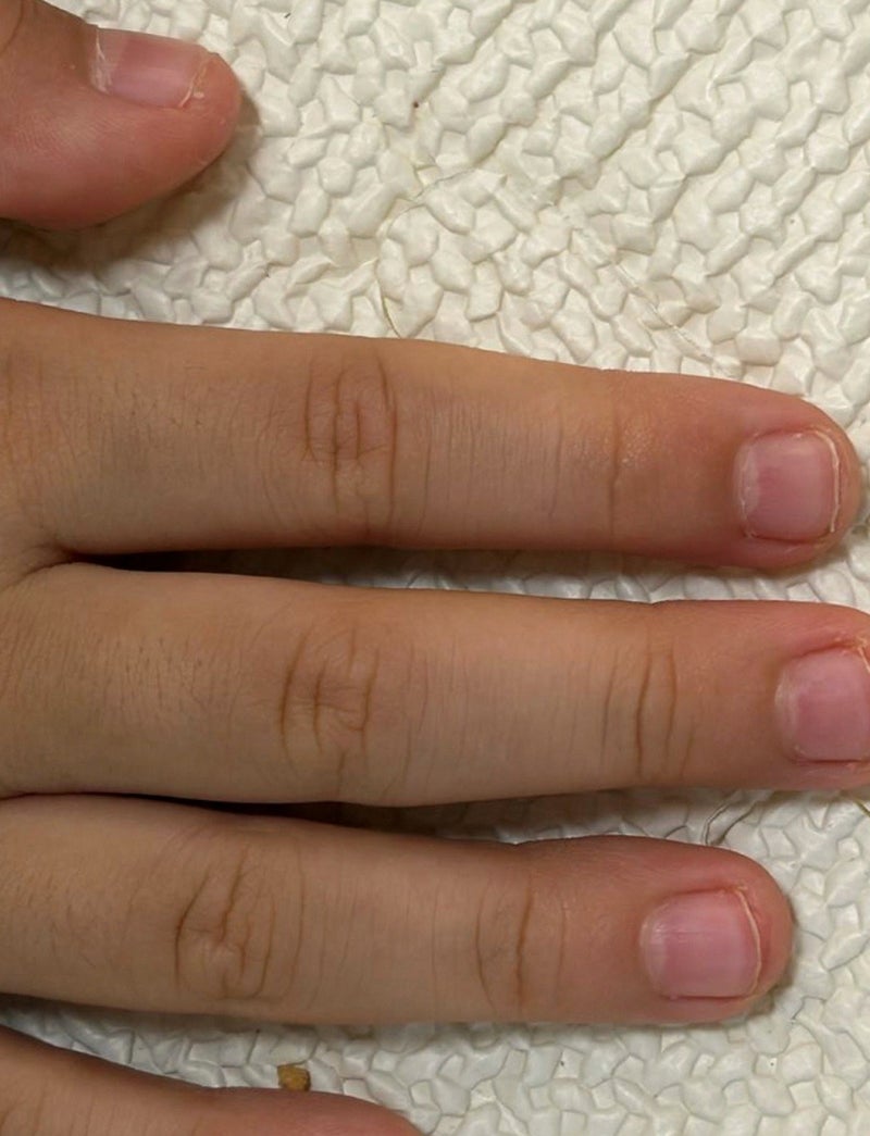 손톱뜯는버릇 고치기 3주｜처음 손톱깎이 꺼낸 후기