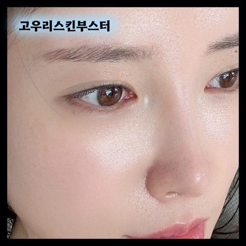 부산피부과 고우리 스킨부스터 주사 시술 전후 변화 기록 후기