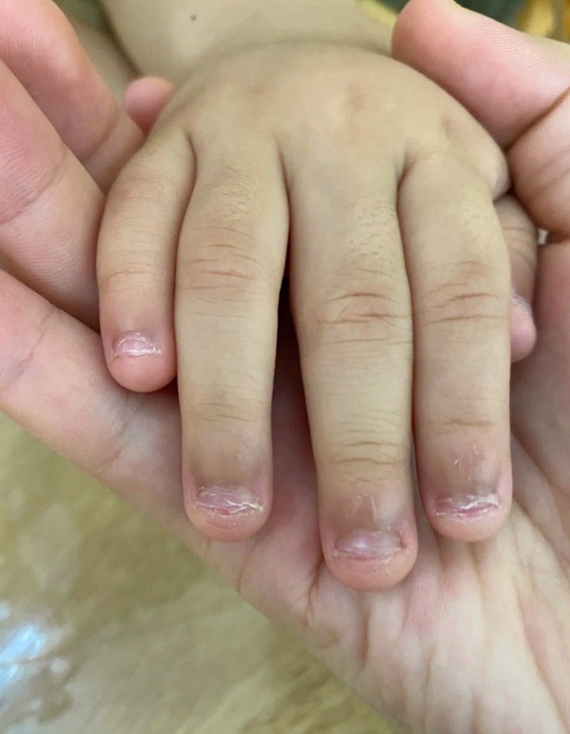 5살 아이 손톱물어뜯기방지 새 학기 내내 손톱깎이가 필요 없어요