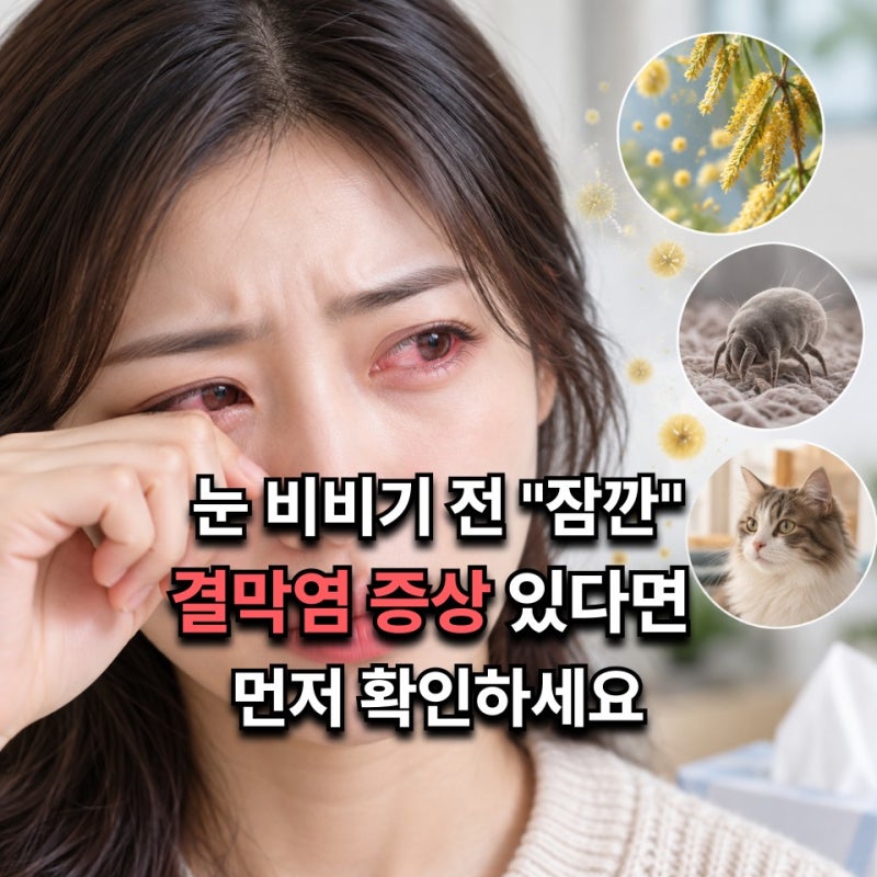 "아침부터 눈 가렵고 충혈됐다면?" 결막염 의심될 때 먼저 볼 3가지