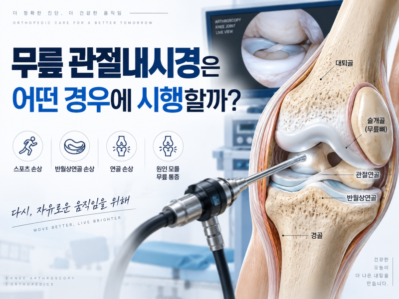 무릎 관절내시경은 어떤 경우에 시행할까?