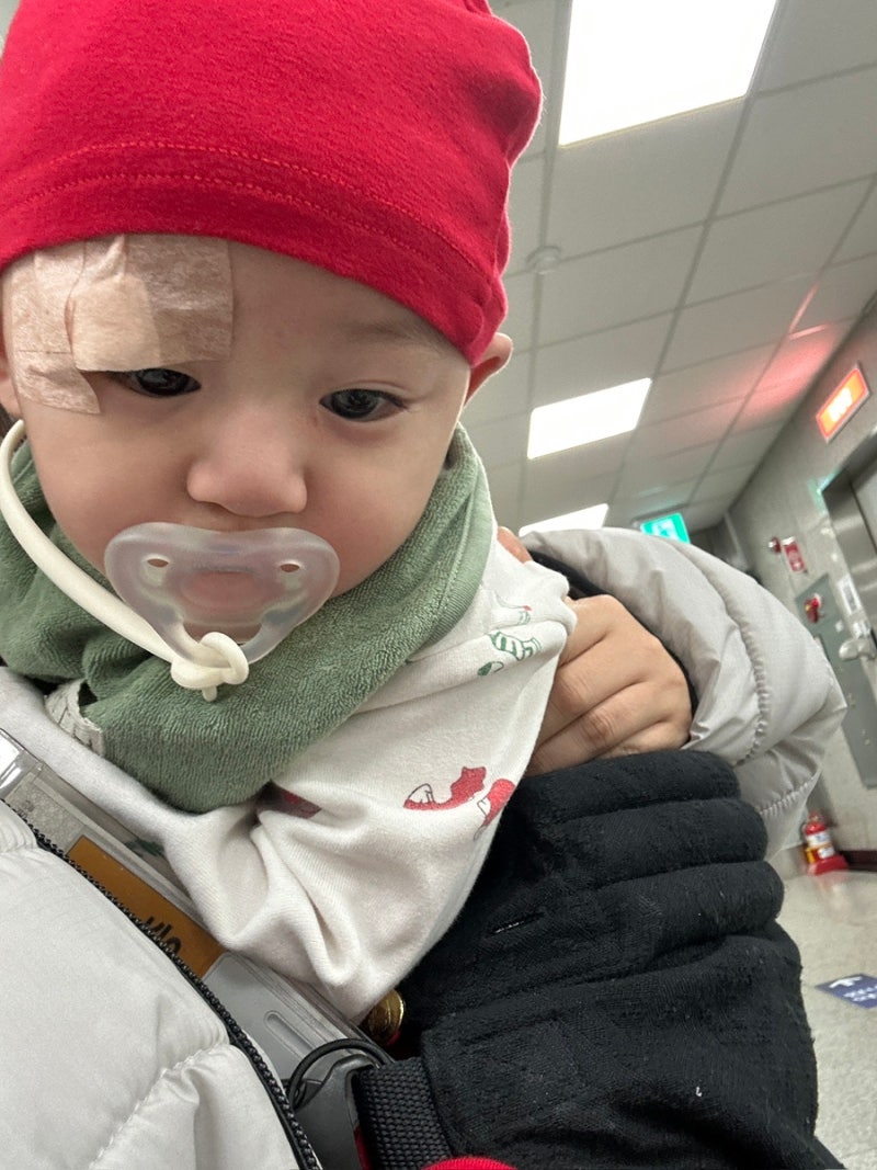 광명 성애병원 8개월아기 눈가상처 봉합수술 후기(+경과관찰)