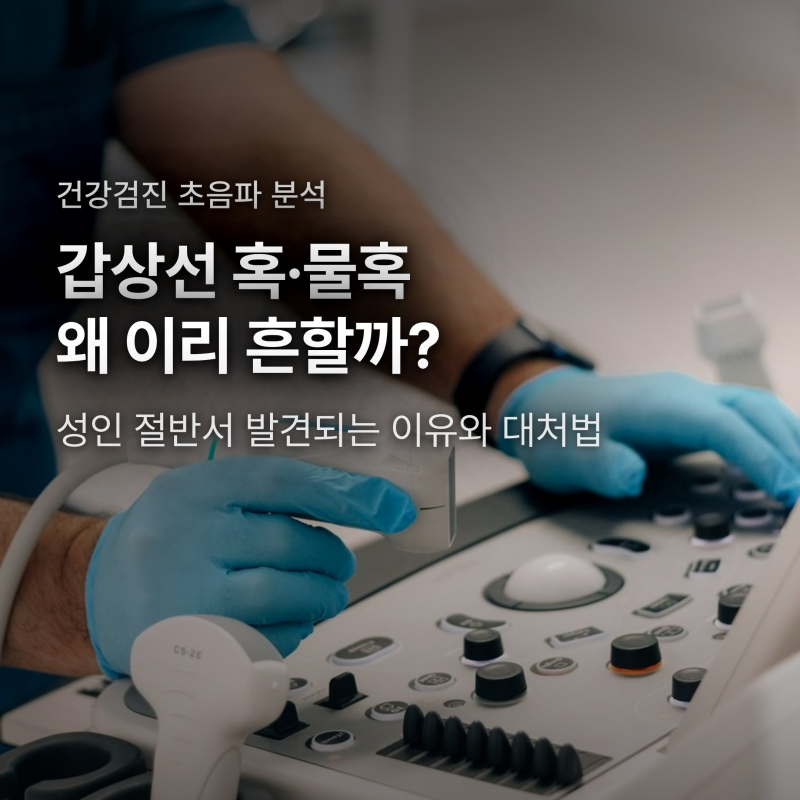 갑상선 결절·낭종 초음파에서 왜 이리 흔할까? 암 구별하는 핵심 기준