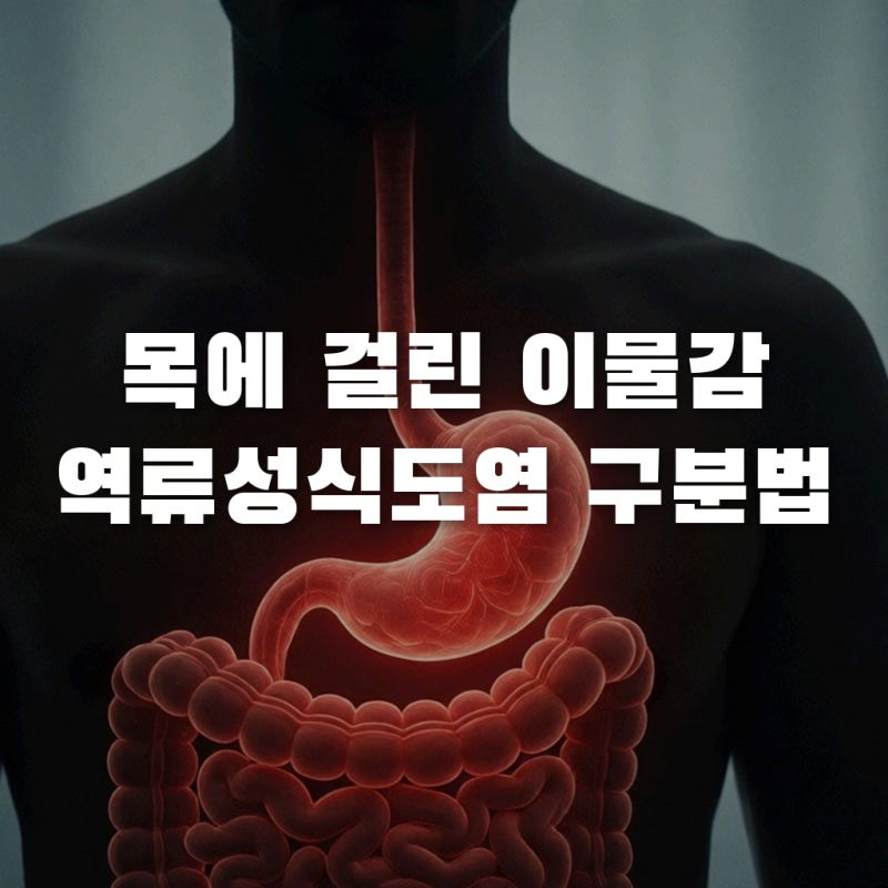 역류성식도염 목이물감, 헷갈리는 인후염 구별법과 단계별 대처 가이드