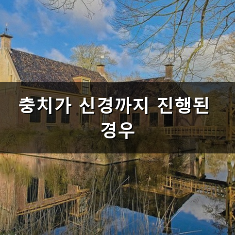 갑자기 찾아오는 치통 원인 무엇일까요?