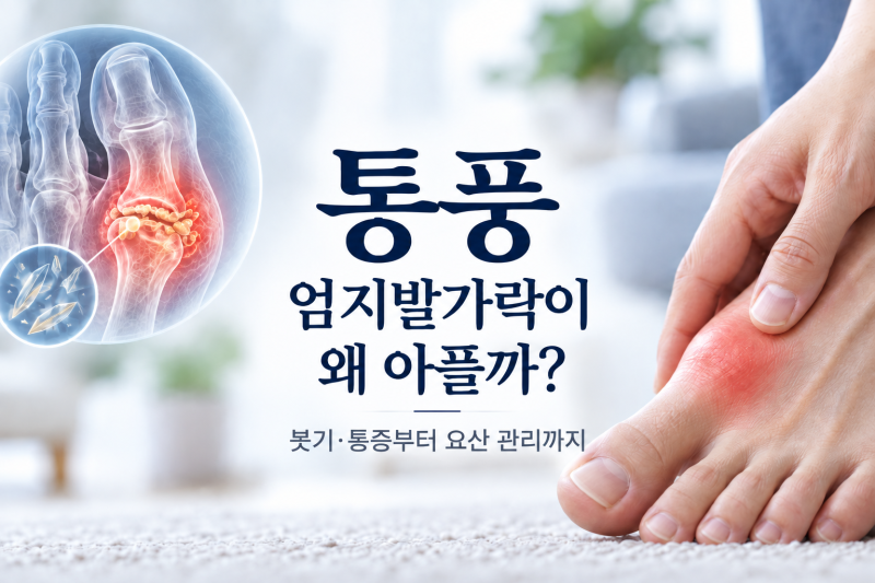 통풍은 왜 엄지발가락부터 아플까? 초기증상·요산 수치부터 치료까지