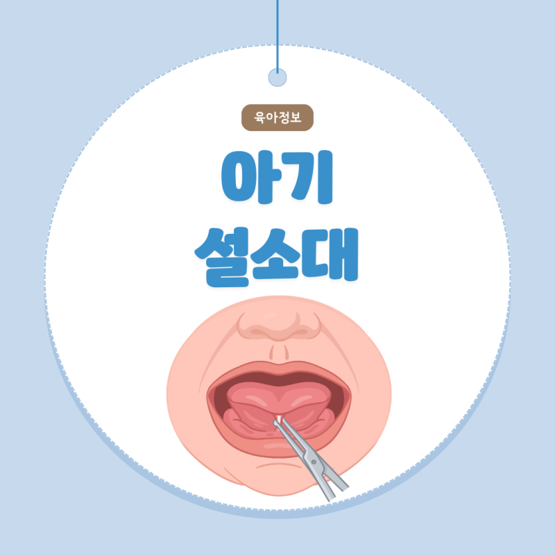아기 설소대 단축증 수술 필수일까? (시기 짧음 확인방법)
