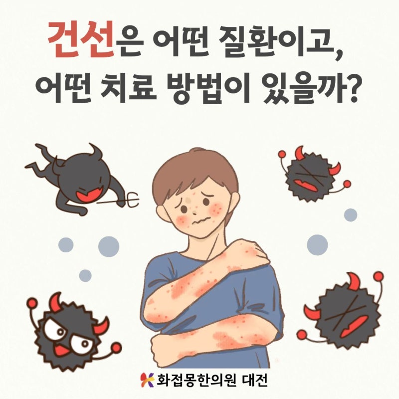 대전건선) 건선은 어떤 질환이고, 어떤 치료 방법이 있을까?