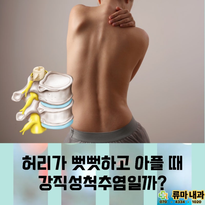 인천 옹진군 강직성 척추염 주사 후 아픔이 느껴진다면 원인은 무엇일까?