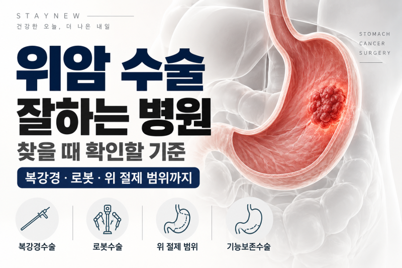 위암 수술 잘하는 병원 찾을 때 확인할 기준