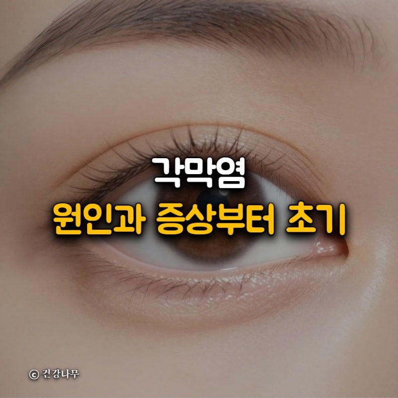 각막염원인과 증상부터 초기 대처법까지 눈 건강 지키는 방법