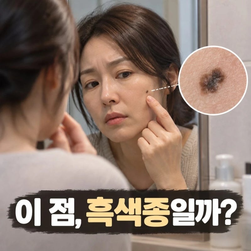 점이 아니었다니? 피부암 흑색종 초기증상부터 구분하는 법. 예방수칙 정리