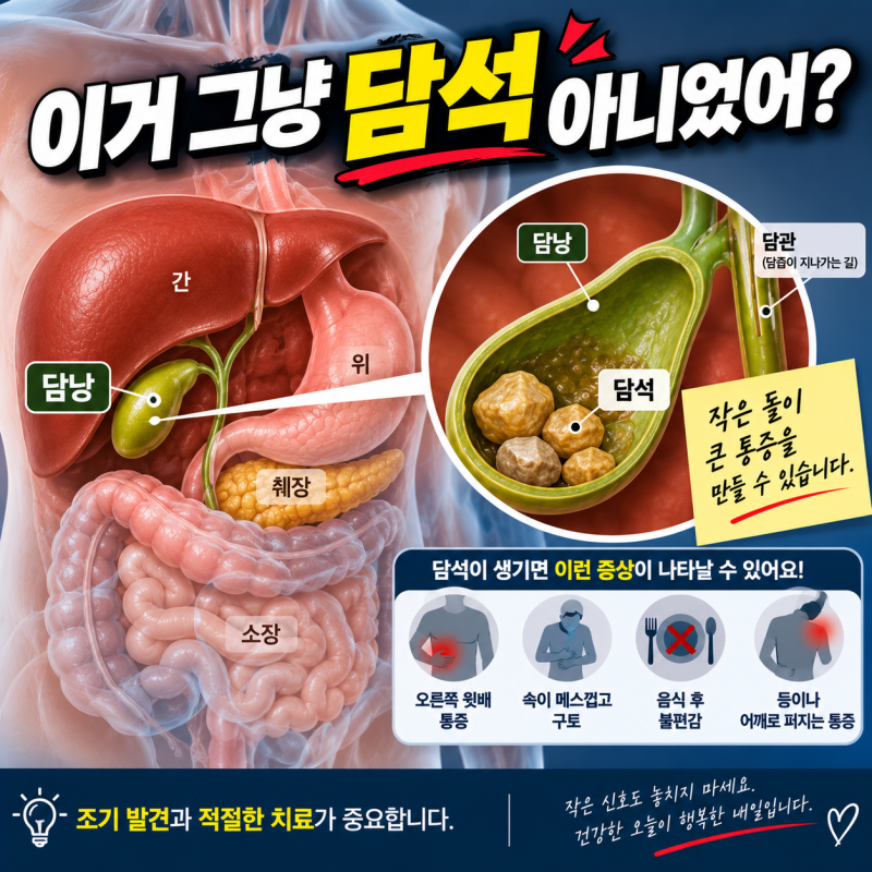 담낭암, 담석이랑 헷갈려서 늦게 발견되는 이유
