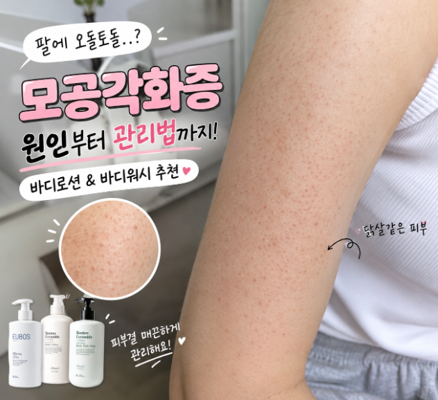 팔에 오돌토돌 닭살 피부? 모공각화증 원인과 바디워시/바디로션 추천 총정리