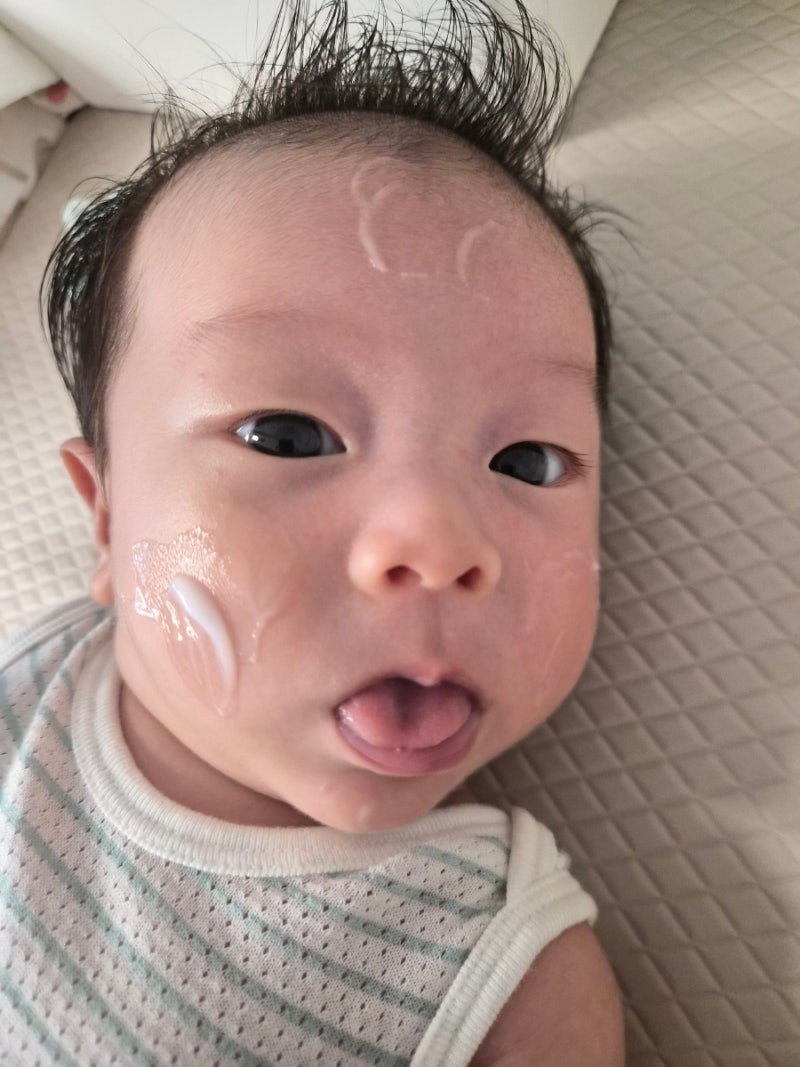 신생아 태열 올라왔을 때 아토팜 수딩젤+로션으로 극복한 후기
