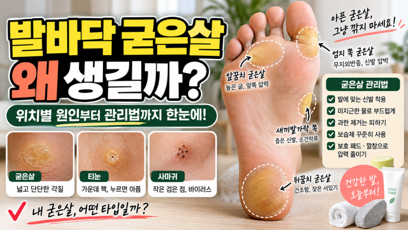 발바닥 굳은살, 왜 같은 자리에 생길까? 위치별 원인과 올바른 관리법