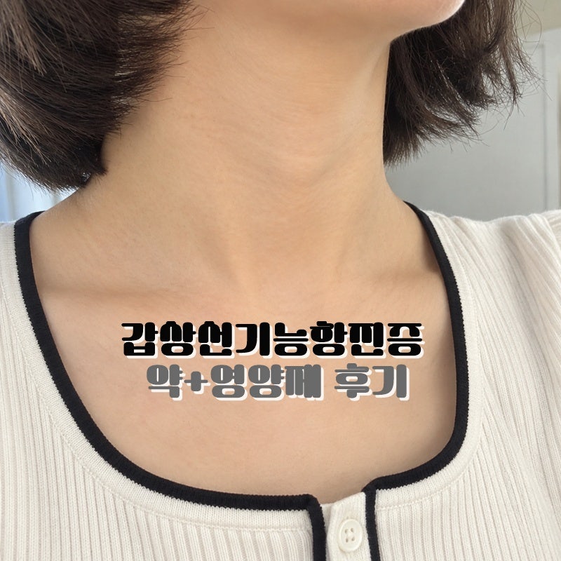 갑상선기능항진증에 좋은 영양제 메티마졸 병행 4달째후기