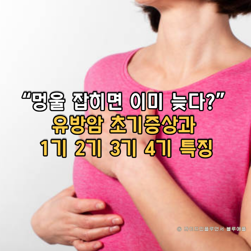 "멍울 잡히면 이미 늦다?"유방암 초기증상과 1기 2기 3기 4기 특징