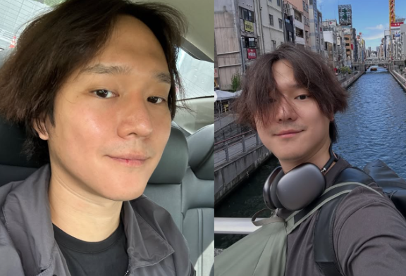 "하루 만에 턱선 복구? 고경표, '입금 전후' 논란 종식시킨 날렵한 정색 셀카"