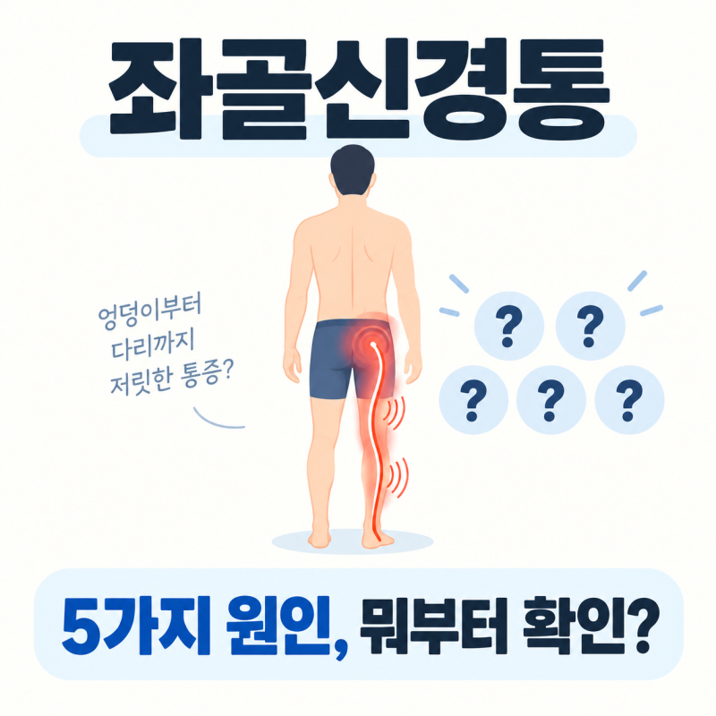 좌골신경통 판단 기준 5단계, 원인 감별·응급 신호·이상근 증후군·자가 관리 (허리 디스크....