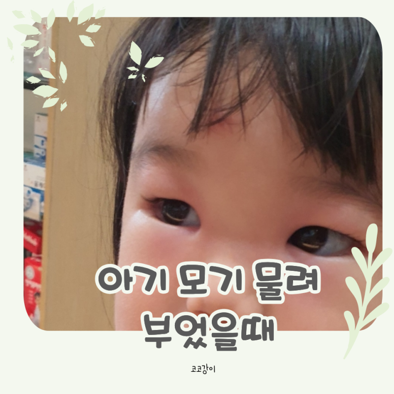 아기 모기 물렸을때 눈주변 부었을때 알레르기 증상
