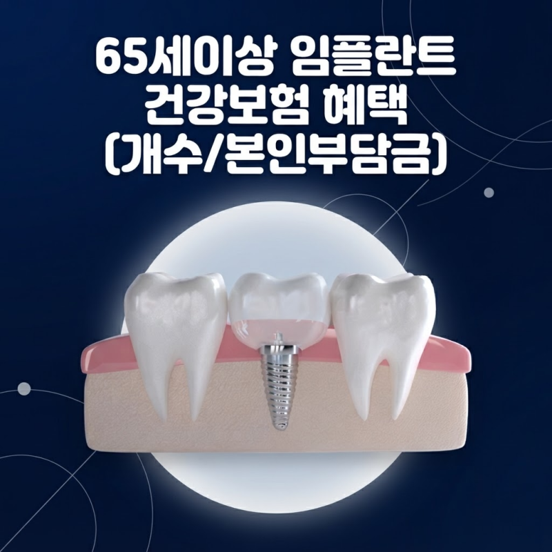 65세이상임플란트 건강보험 혜택 개수와 본인부담금 확인하기