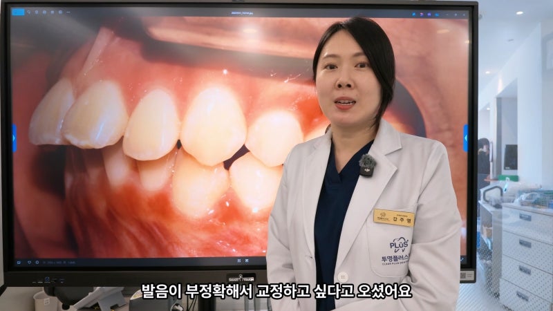 돌출입교정, 앞니돌출·2급부정교합이라면 상악발치교정은 언제 고려할까?