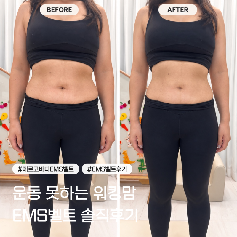 (할인코드 공유)운동 못하는 워킹맘의 에르고바디 EMS벨트 솔직후기