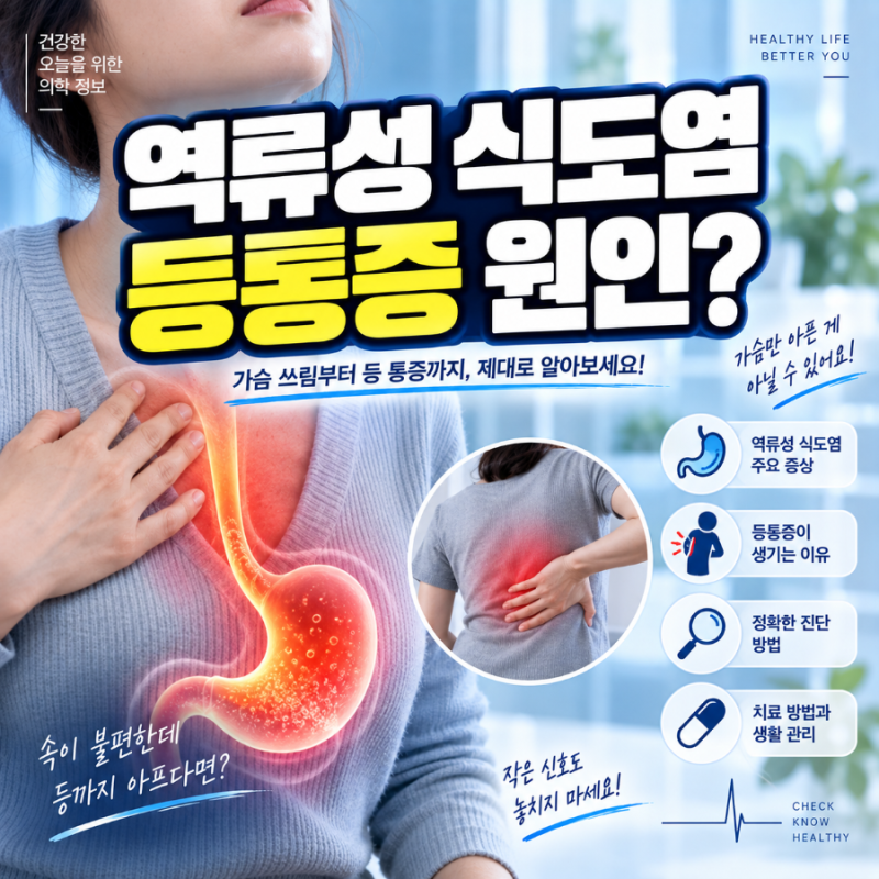 역류성 식도염 등통증 연관성 증상과 치료법 완벽 정리
