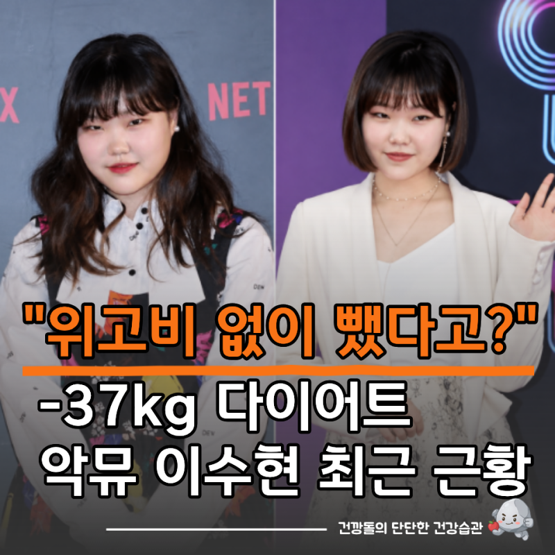"위고비 없이 37kg 뺐다고?" 이수현 다이어트 최근 근황 어떻길래