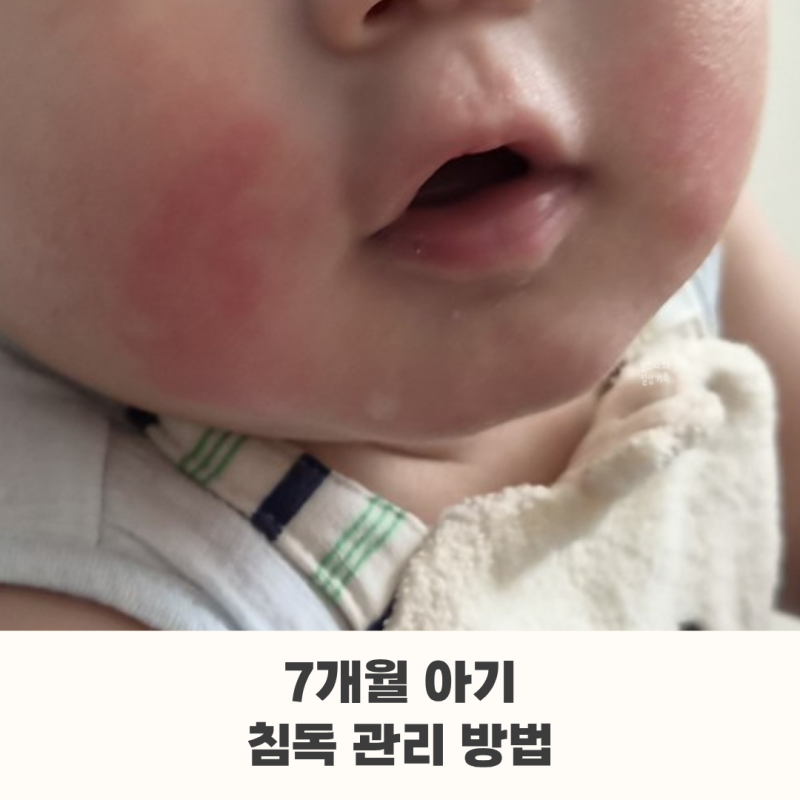 7개월 아기 침독 관리 방법 | 이유식, 비판텐, 리도맥스