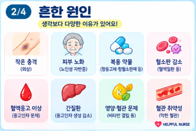 멍이 자주 드는 이유｜단순한 피부 문제부터 혈액·약물 문제까지