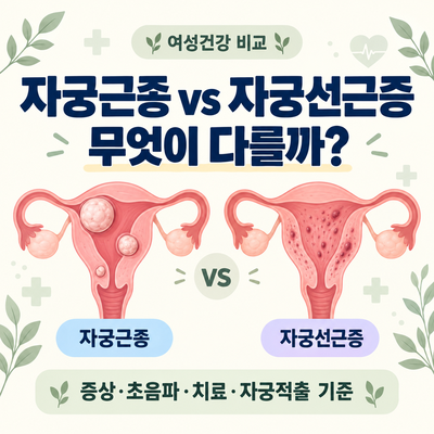 자궁근종·자궁선근증 차이 총정리｜증상·초음파·치료와 자궁적출 기준