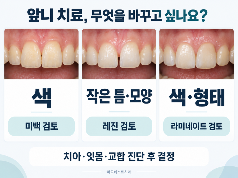 마곡 앞니 레진·미백·라미네이트, 삭제 범위와 총비용까지 비교하는 선택 기준
