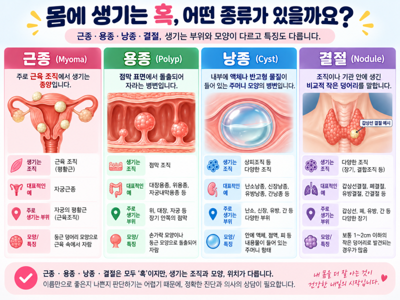 건강검진에서 '혹'이 발견되었다면? 근종· 용종·낭종·결절 차이 총정리