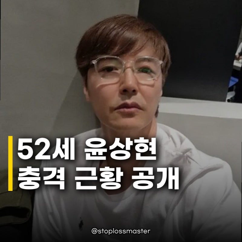 윤상현 52세 근황 변화, 수염 밀고 달라진 비주얼에 일본 팬들 열광