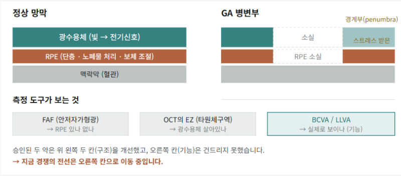 건성 황반변성 치료제 경쟁 지도