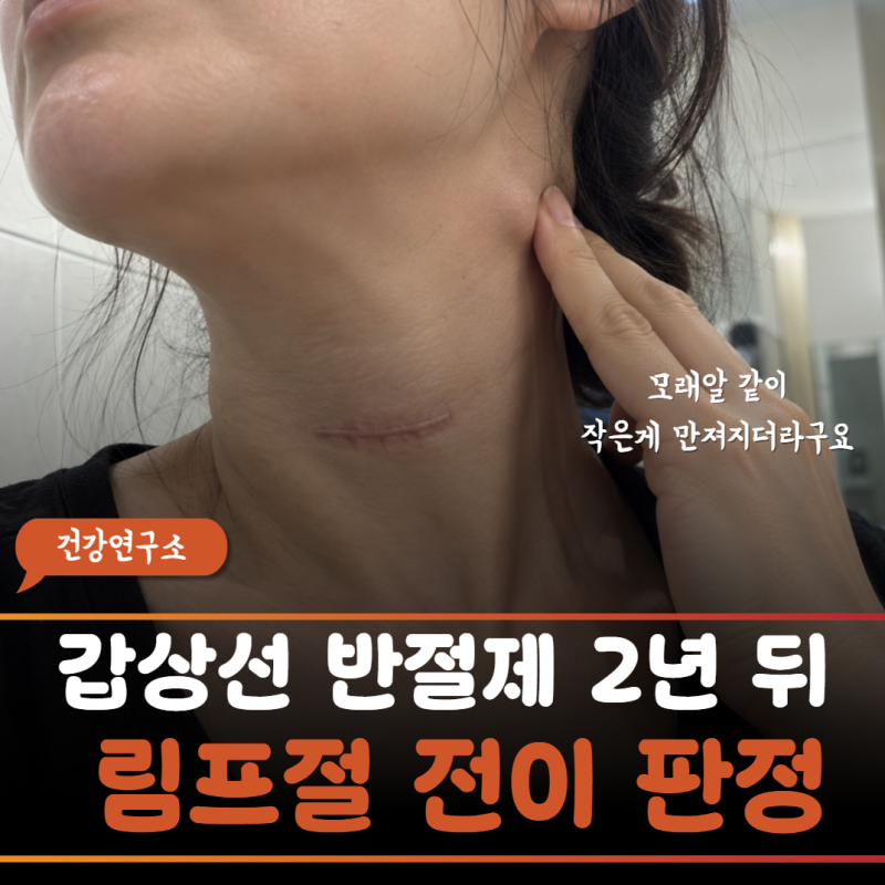 ‘착한 암이라 반만 떼면 끝난다더니…’갑상선 수술 2년 만에 경부 림프절 전이와 초음파 ....