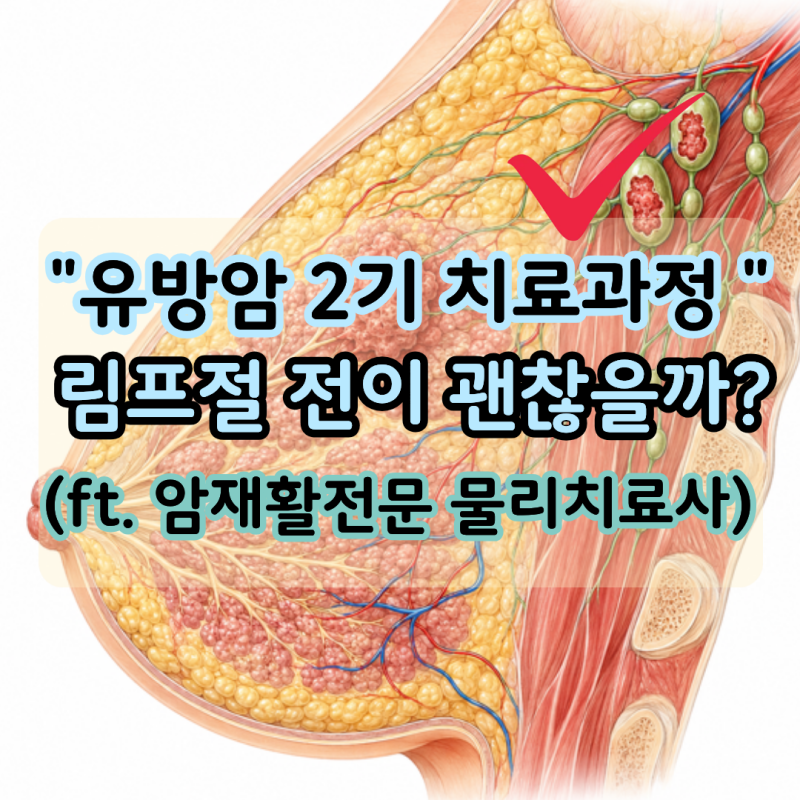 "유방암 2기 진단" 림프절 전이가 있다면? 수술과 항암 치료 과정 (ft. 암재활전문 물리치료사)