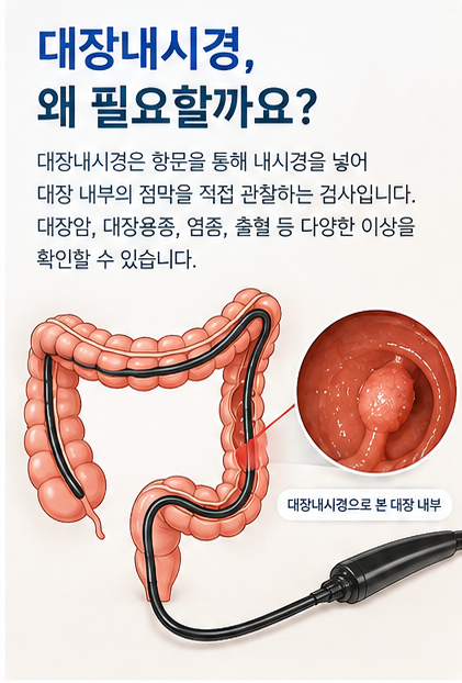 대장내시경 검사 전 꼭 알아야 할 것들: 검사 목적·준비사항·가격 정리