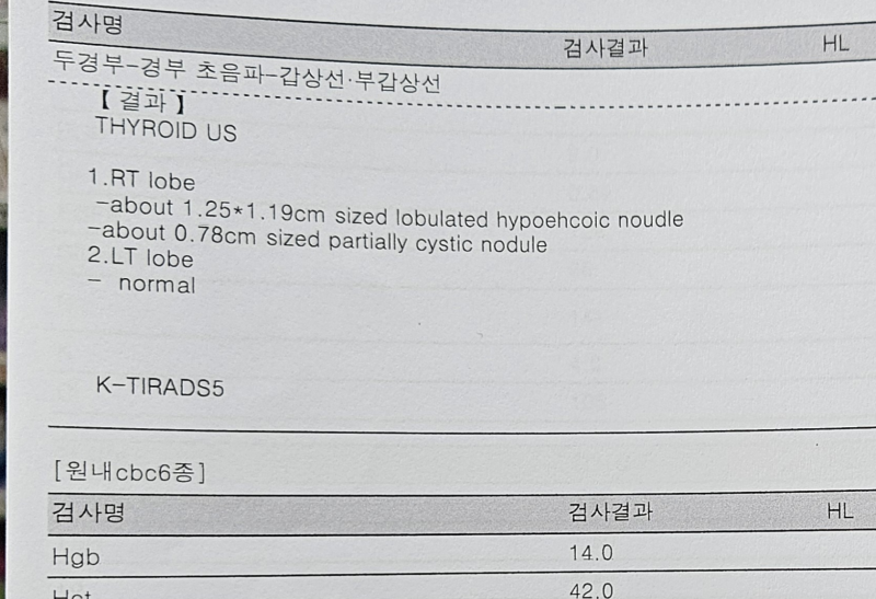 갑상선암 이야기 | #1. 전조증상, 발견, 확진까지