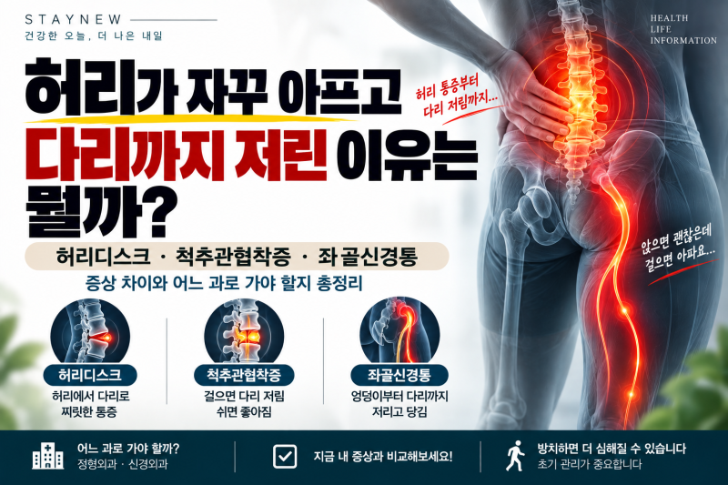 허리가 자꾸 아프고 다리까지 저린 이유는 뭘까?허리디스크·척추관협착증·좌골신경통 증상....