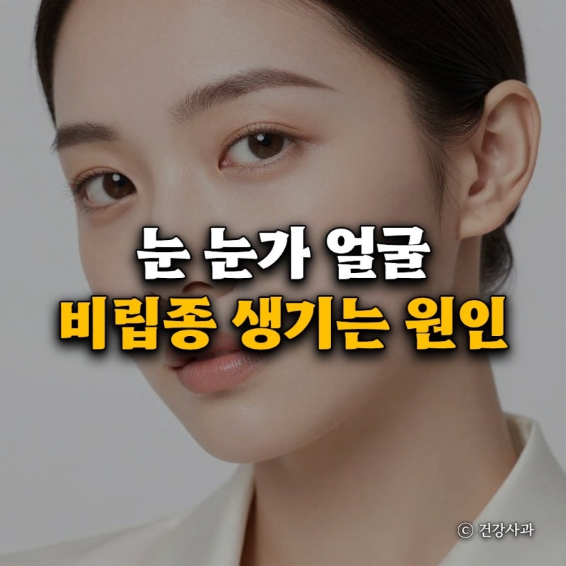 눈 눈가 얼굴 비립종 생기는 원인 제거 비용 제거후 관리 핵심 정리