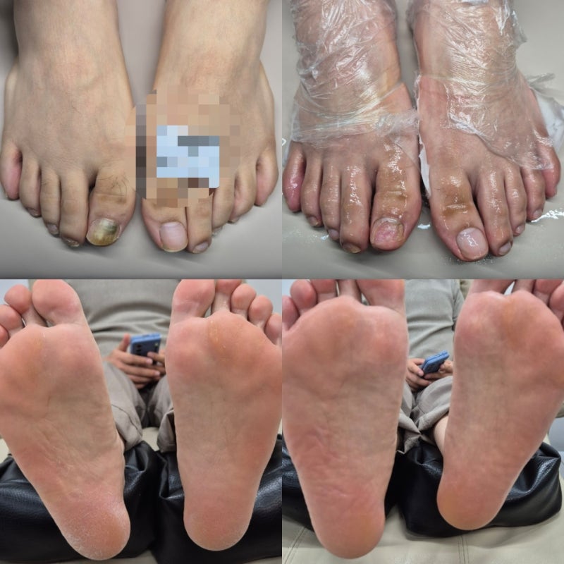 고양발간지러움 원인부터 해결