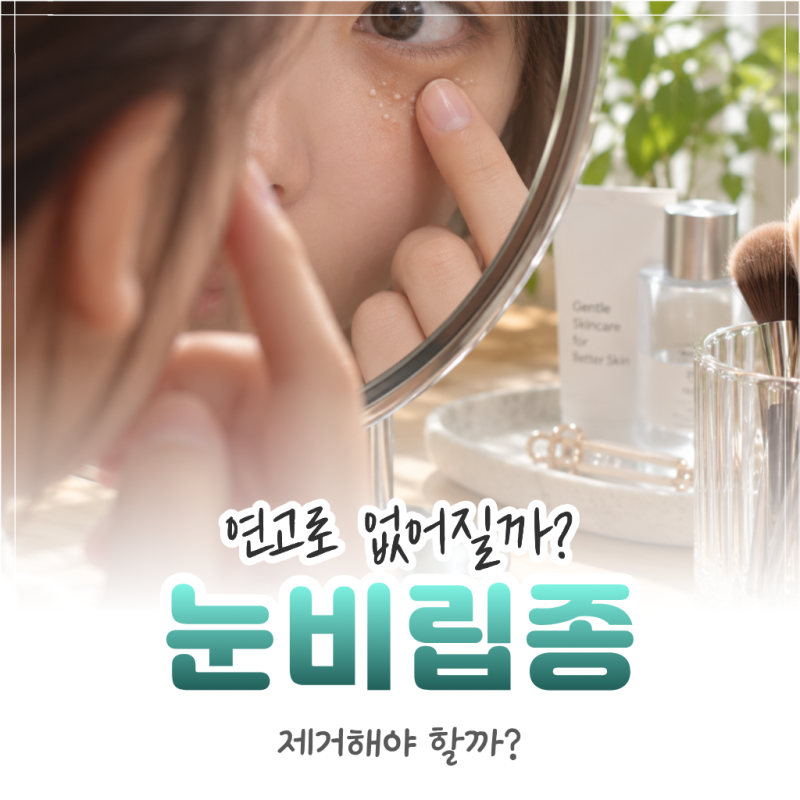 눈비립종 원인, 제거 비용과 연고로 없어질까? 정리