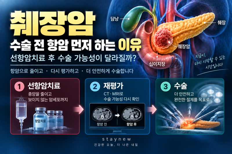 췌장암 수술 전 항암 먼저 하는 이유 / 선항암치료 후 수술 가능성이 달라질까?