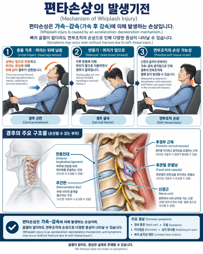 의학이론 제5편 척추·신경계ㅣ제2장 경추 염좌와 편타손상