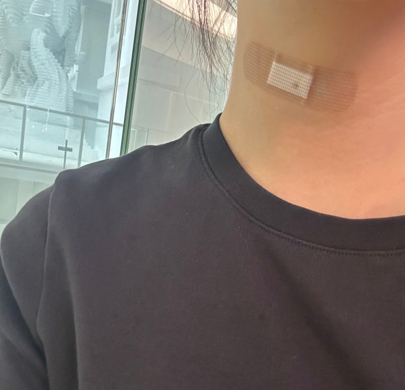 [30대 갑상선암 진단 수술전 병원 결정까지의 과정] 로봇수술 절개수술 장단점 갑상선 포럼 ....